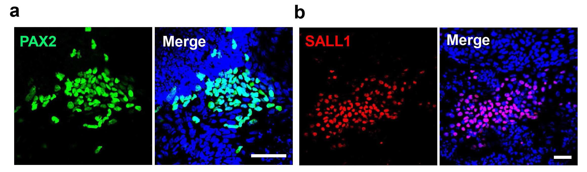 인간 배아 줄기세포 유래의 중간 중배엽에서 OSR1 이외의 특이마커 유전자의 면역형광염색에서의 발현 결과