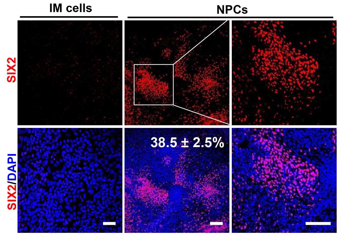 인간 배아 줄기세포 유래의 신장 전구세포에서 특이마커 유전자 SIX2 발현의 면역형광염색 결과