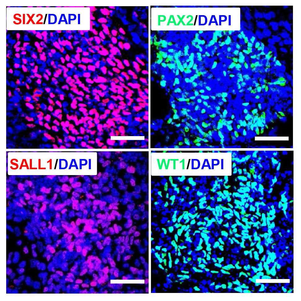 인간 배아 줄기세포 유래의 신장 전구세포에서 다양한 특이 마커 유전자 발현의 면역형광염색 결과