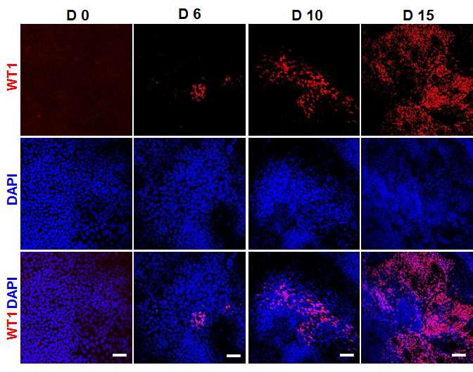 인간 배아 줄기세포 유래의 신장 전구세포에서 시간에 따른 WT1 발현의 면역형광염색 결과