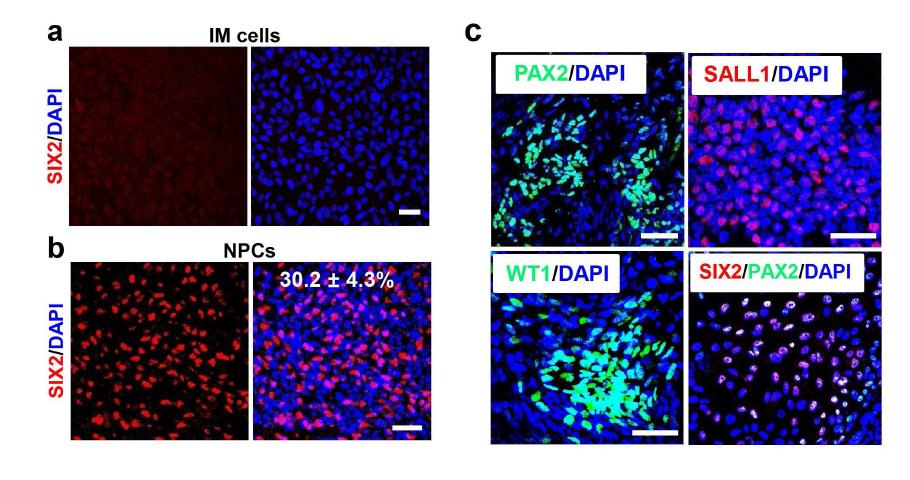인간 역분화 줄기세포 유래의 신장 전구세포에서 특이 마커 유전자 발현의 면역형광염색 결과