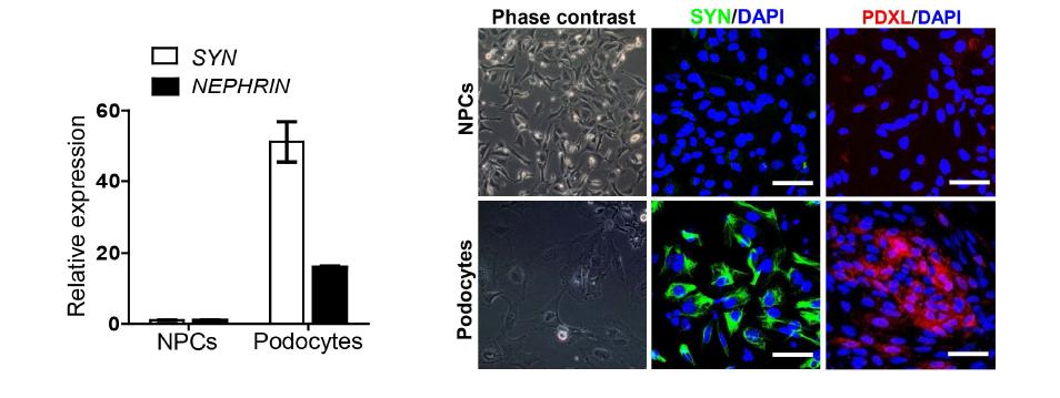 인간 배아 줄기세포 유래의 신장 전구세포에서 사구체 족세포로의 분화 유도 후 특이 마커 유전자의 발현 결과