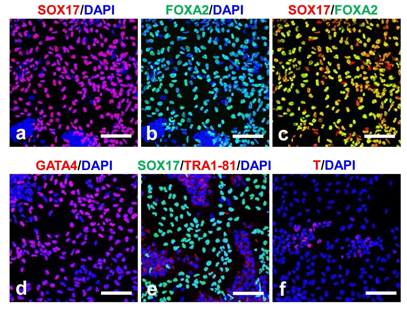 인간배아줄기세포 유래의 내배엽 세포에서 각 계통별 특이적 마커 유전자 발현에 대한 면역형광염색 결과