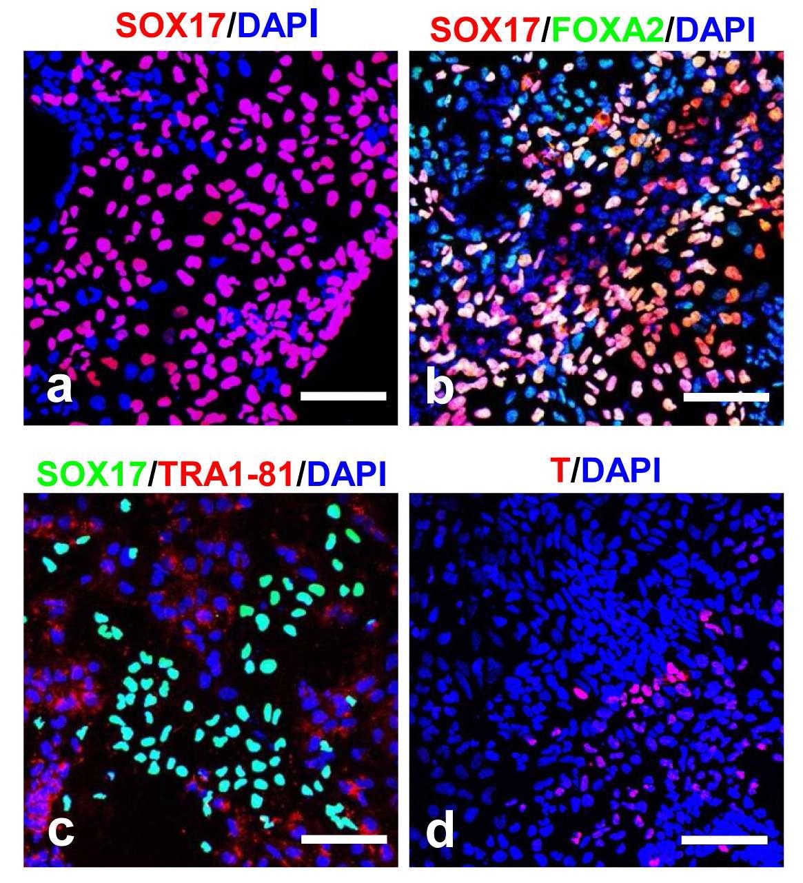 인간 역분화 줄기세포 유래의 내배엽 세포에서 내배엽 및 중/ 외배엽 특이 마커 발현에 대한 면역형광염색 결과