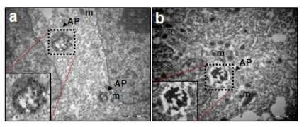 오토파고좀으로 예상되는 세포 소구조체가 실제 오토파고좀인 것을 LC3 항체를 사용하여 미세골드 입자를 이용한 면역골드전자 현미경 방식으로 증명함.