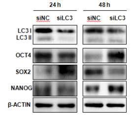 LC3-siRNA가 줄기세포 특이적 단백질들의 증감에 미치는 영향. 각각의 줄기세포 특이적 단백질들에 따라 LC3유전자의 knock-down (KD)에 따른 축적 양상이 다르게 관찰됨 (siNC; negative control siRNA, siLC3; LC3-siRNA).