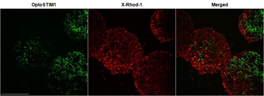 X-Rhod-1을 이용한 OptoSTIM1-H9의 기저 칼슘농도 확인