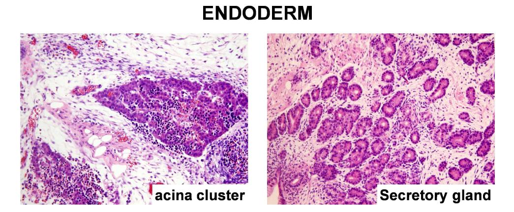 정상 역분화줄기세포로부터 형성된 teratoma - endoderm 계열