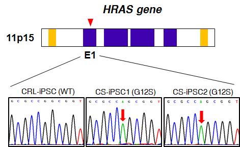 HRAS 유전자의 변이 확인