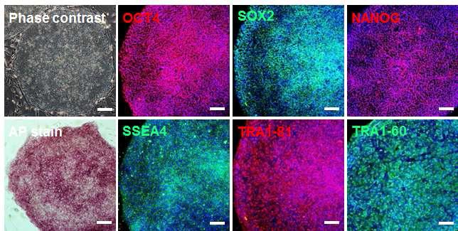 Costello 역분화줄기세포(CS-2)의 줄기세포 마커발현 확인