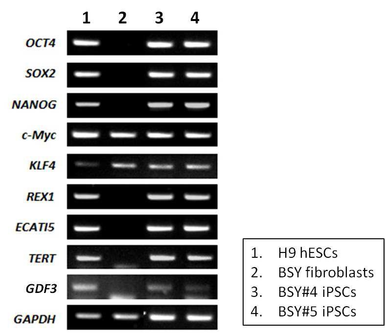 BSY 역분화 줄기세포주의 유전자발현(RT-PCR)