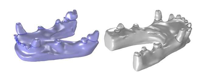 치료계획3: 임상자료의 분석 실시: 3D 모델 제작