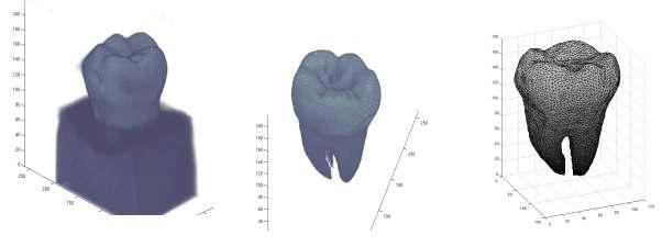 제작된 치아모델의 3차원 재구성영상(오른쪽)과 영상분할기법으로 치아만 선택된 화면(중간). 딜라우니 삼각법을 적용하여 치아의 유한요소화한 결과(오른쪽)