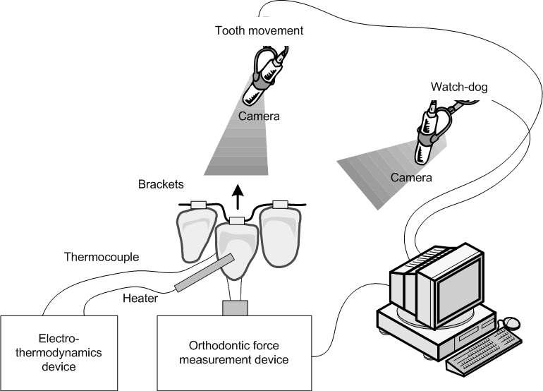 타이포돈트 시스템을 이용한 치아이동 실험장치