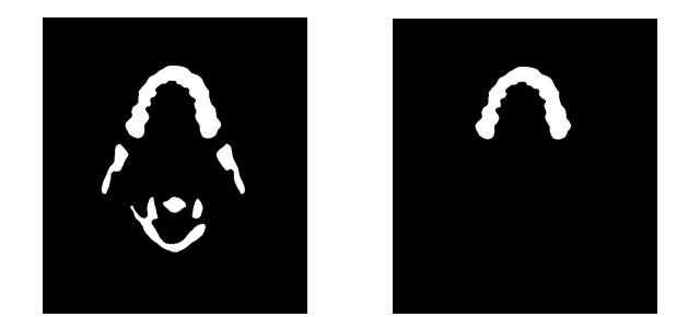 Eroded 이미지(좌)와 치아정보만을 검출한 이미지(우)