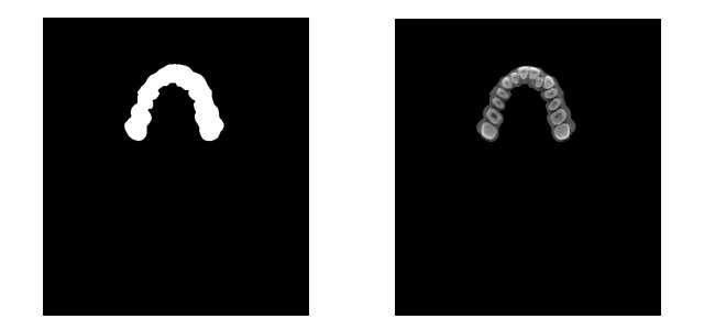 Dilated 이미지(좌)와 치아만을 추출한 이미지(우)