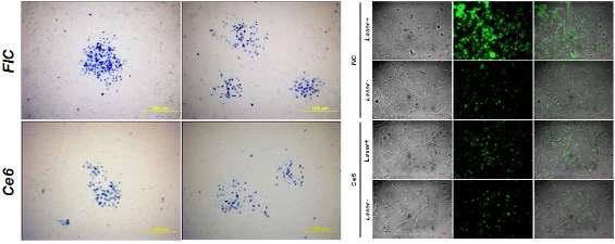 FIC 나노 입자와 Ce6가 함입된 유방암 세포에 국지적으로 670 nm를 조사하고 Trypan Blue로 염색한 후 관찰한 광학 이미지(좌). Annexin V-FITC로 염색한 후 관찰한 광학 및 녹색 형광 이미지(우).