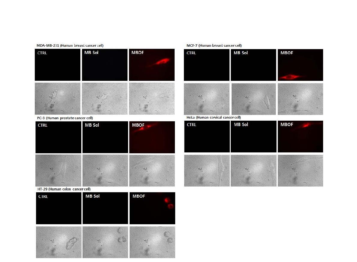 MB 용액 및 MBOF 나노입자의 암세포 세포 내 침투 비교 형광 및 광학이미지. [ MDA-MB-231(유방암 세포), MCF-7(유방암 세포), PC-3(전립선암 세포), HeLa(자궁경부암