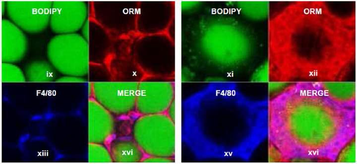 ORM이 대식세포 표면에 염색됨. 왼쪽이 lean, 오른쪽이 DIO 생쥐의 지방조직