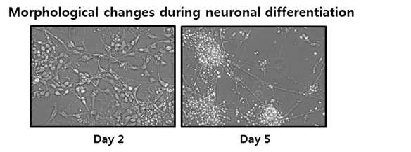 마우스 배아줄기세포의 신경세포 분화후 세포 형태 관찰