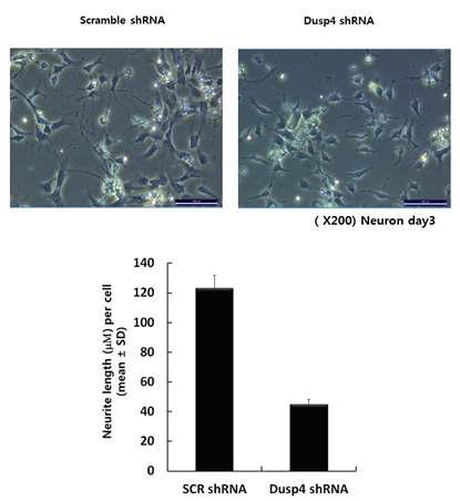 shRNA를 통해 dusp4의 발현을 억제 시킨 후 신경세포로 분화, neurite outgrowth를 측.