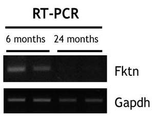 RT-PCR을 통한 fukutin 발현의 확인