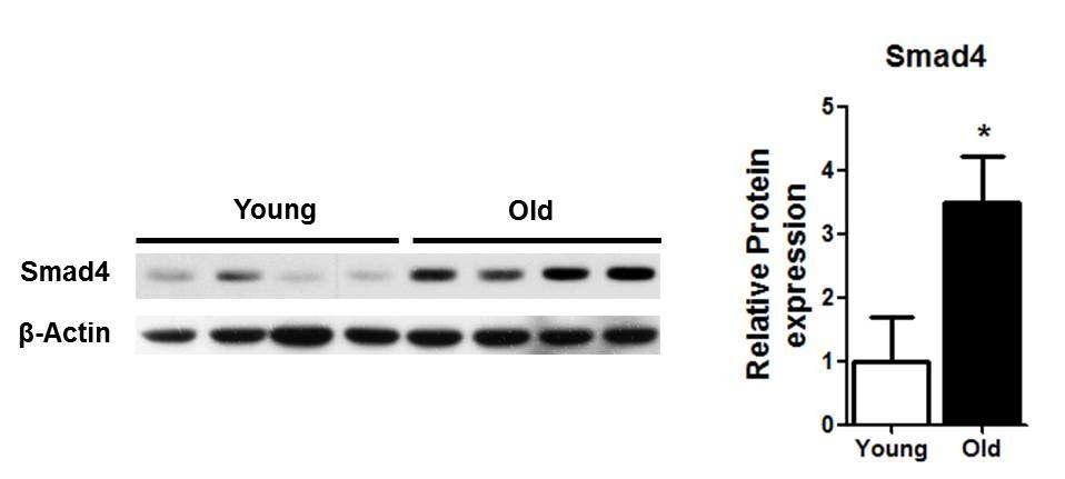western blot을 통한 SMAD4 protein level의 확인