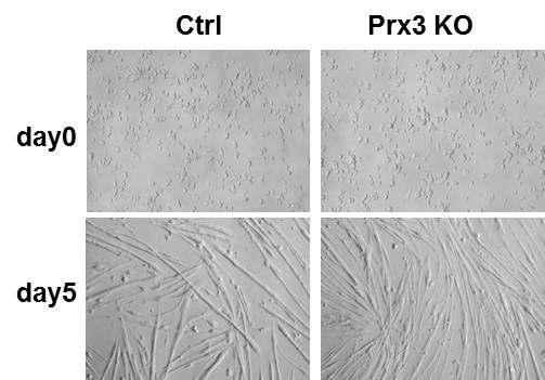 Prx3 KO로부터 분리한 근육 성체줄기세포의 근육분화능 비교