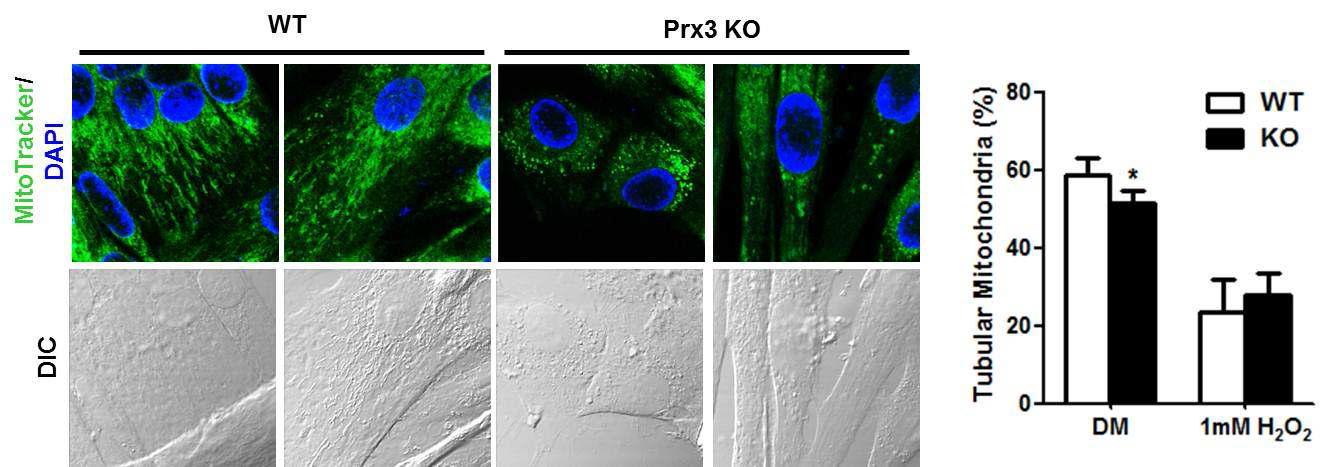 Mitochondrial network 분석: Prx3 KO myotube에서 mitochondria fragmentation 이 증가함