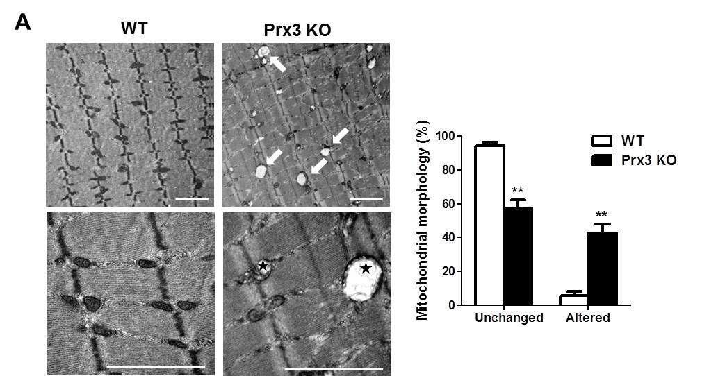 Prx3 KO Soleus 근육조직 전자현미경 분석에서 비정상적인 미토콘드리아 확인