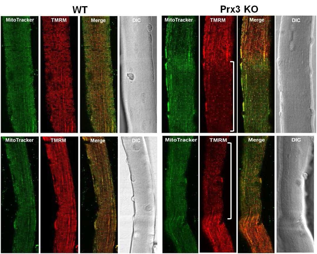 Prx3 KO FDB muscle fiber의 감소된 미토콘드리아 활성도