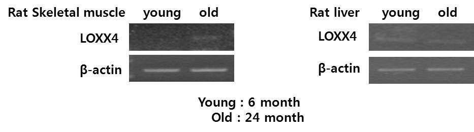 LOXX4 유전자의 노화에 의한 근육 특이적 발현 증가