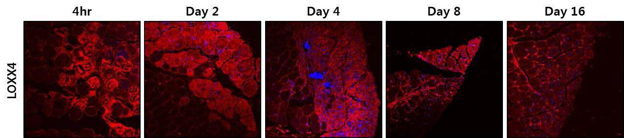LOXX4의 근육 손상 후 재생 동안 조직 단면에서 단백질 발현 패턴