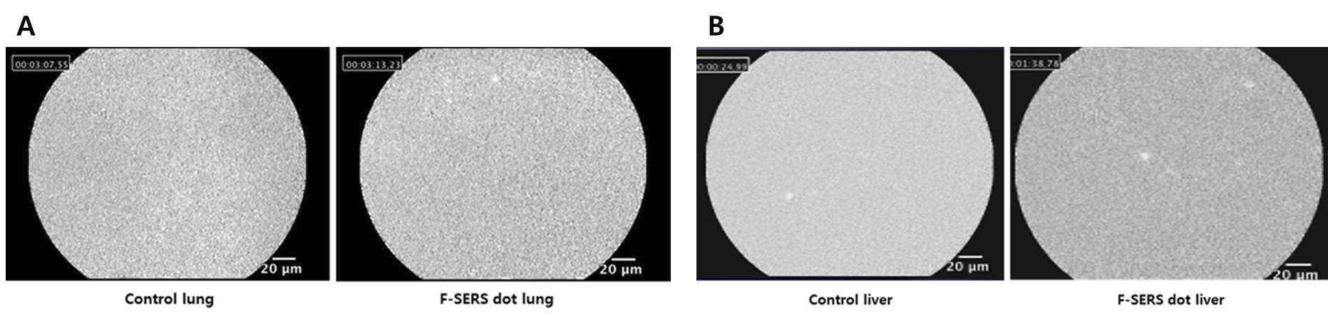 F-SERS dot을 꼬리정맥 주사 한 마우스의 간 (A), 폐 (B)의 Cell vizio 형광 측정