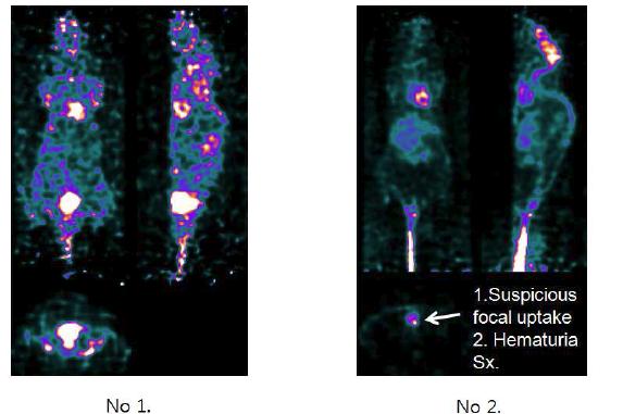 Bladder cancer cell line을 이용한 orthotopic xenograft PET image