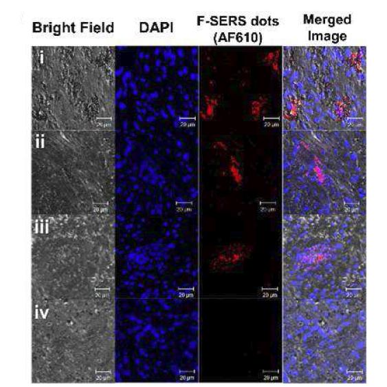 Antibody conjugatged F-SERS dot의 confocal image