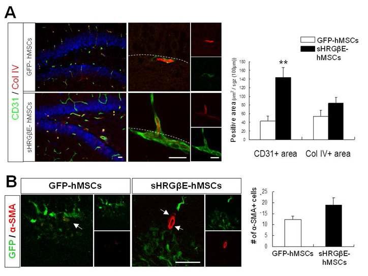 HRGβ E-hMSCs에 의한 DG 내 CD31+ 신생 혈 관 영역 증가 및 이 에 따른 SMA+ pericyte 증가 경향 성 확인