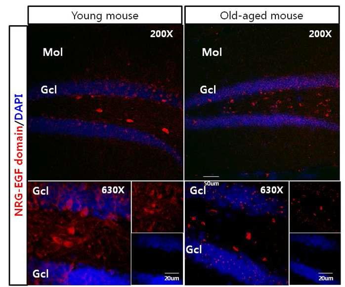 HRG (EGF domain)을 발현하는 세포는 젊은 쥐보다 적으나 노화 쥐에서도 hillus에 소 수 보임