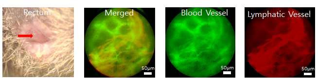 양자점과 FITC-Dextran을 이용한 다중 형광 혈관 촬영.