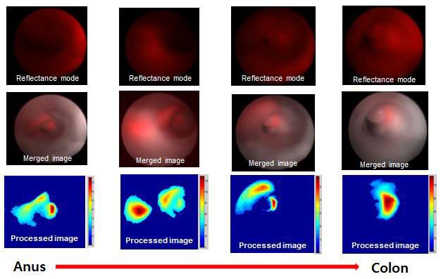 마우스 종양 모델의 anus로부터 colon 내부까지의 분자영상촬영.