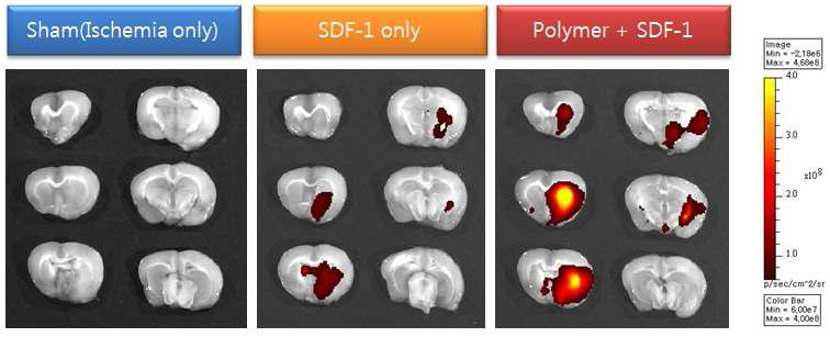 뇌졸중을 유발시킨 쥐 모델에 Polymer-SDF-1 샘플을 정맥 투여한 Optical Imaging 결과