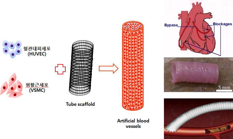 도관 형태의 혈관 세포 인공지지체 제작