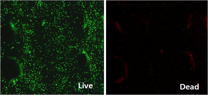 형광 현미경을 이용한 Live/Dead Cell Assay 결과