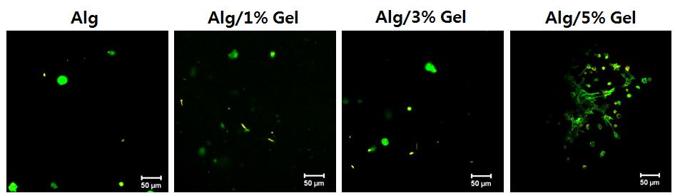 Alginate + Gelatin 인공지지체에서의 연골 세포의 골격과 핵의 형상