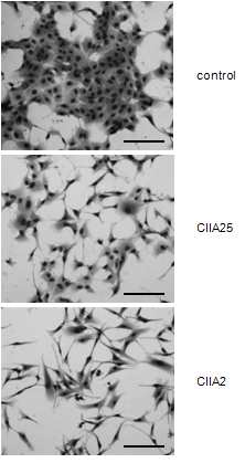 MDCK cells were cultured under a humidified 5% CO2 at 37°C in DMEM supplemented with 10% FBS. They were transfected with an expression vector for FLAG epitope-tagged CIIA or with an empty vector (control), and two clones overexpressing CIIA (CIIA2, CIIA25) were chosen for subsequent studies after selection with puromycin (1.8 mg/ml). The stably transfected cells were visualized with the use of a Diff-Quick staining kit (Sysmex,Japan) and an Axiovert 200 microscope (CarlZeiss). Scalebars,100mm.