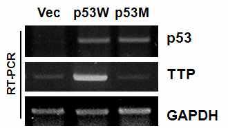 KM12C 세포에 p53 wild type과 mutant 유전자를 transfection 시킨 후 12시간 및 18 시간에 RT-PCR을 사용하여 TTP 발현을 분석함.