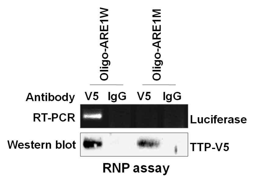 TTP가 Lin28 mRNA 3'UTR의 ARE1과 결합하는 지 조사하기 위해 ChiP assay를 수행한 결과 TTP 및 Lin28-ARE1을 cotransfection 한 후 세포를 고정시켜서 RNA를 추출하고 Lin28의 ARE를 포함한 primer를 제작하여 RT-PCR로 확인한 결과 wild-type Lin28-ARE1와 반응한 sample에서 band 확인됨