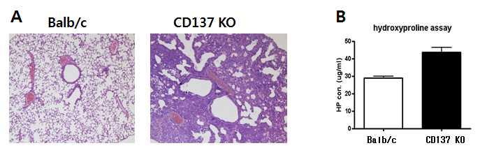 폐섬유증은 CD137 KO 생쥐에서 그 정도가 심함