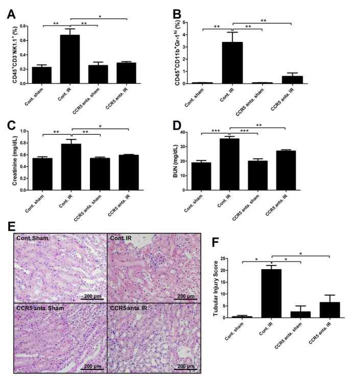 CCR5 is involved in recruiting NK cells during kidney IRI.