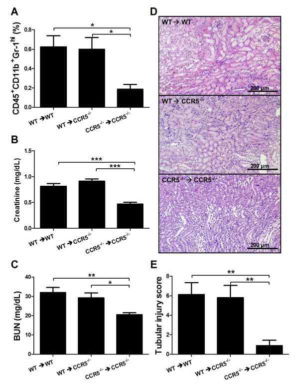 CCR5 is involved inrecruiting NK cells during kidney IRI. CD3-NK1.1+ NK cells were purified from WT or CCR5-/- spleens using the MoFlow cell sorter and adoptively transferred into WT and CCR5-/- or CCR5-/- mice, respectively, 1 h before kidney IR. Samples were obtained 25 h after kidney IR.